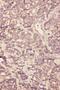 Fibroblast Growth Factor 19 antibody, PA5-79251, Invitrogen Antibodies, Immunohistochemistry frozen image 