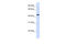 TRNA Aspartic Acid Methyltransferase 1 antibody, 26-329, ProSci, Western Blot image 