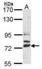 Delta Like Canonical Notch Ligand 4 antibody, GTX109649, GeneTex, Western Blot image 