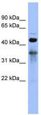RNA Binding Fox-1 Homolog 2 antibody, TA345761, Origene, Western Blot image 