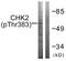 Checkpoint Kinase 2 antibody, abx012469, Abbexa, Western Blot image 