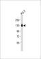 CD49c antibody, M02902-1, Boster Biological Technology, Western Blot image 