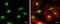 RAD51 Recombinase antibody, GTX100469, GeneTex, Immunofluorescence image 