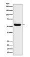 Lipoprotein Lipase antibody, M00316, Boster Biological Technology, Western Blot image 