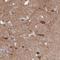 AP2 Associated Kinase 1 antibody, NBP1-84111, Novus Biologicals, Immunohistochemistry frozen image 