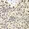 Minichromosome Maintenance Complex Component 6 antibody, A1955, ABclonal Technology, Immunohistochemistry paraffin image 