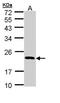 Retinol Binding Protein 4 antibody, GTX110632, GeneTex, Western Blot image 