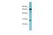 RAS Like Family 12 antibody, A15197, Boster Biological Technology, Western Blot image 