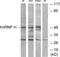 Heterogeneous Nuclear Ribonucleoprotein H2 antibody, GTX87182, GeneTex, Western Blot image 