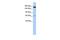 Regulation Of Nuclear Pre-MRNA Domain Containing 2 antibody, GTX45320, GeneTex, Western Blot image 