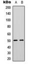Protein Tyrosine Phosphatase Non-Receptor Type 1 antibody, orb304531, Biorbyt, Western Blot image 
