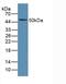 Lymphotoxin Beta Receptor antibody, MBS2005353, MyBioSource, Western Blot image 