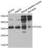 Pyrroline-5-Carboxylate Reductase 1 antibody, A6959, ABclonal Technology, Western Blot image 
