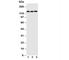 Cadherin 5 antibody, R31190, NSJ Bioreagents, Western Blot image 