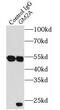 GM2 Ganglioside Activator antibody, FNab03517, FineTest, Immunoprecipitation image 