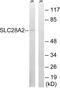 Solute Carrier Family 28 Member 2 antibody, abx014904, Abbexa, Western Blot image 