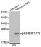 Eukaryotic Translation Initiation Factor 4E Binding Protein 1 antibody, STJ22118, St John