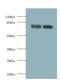 Folate Hydrolase 1 antibody, LS-C317474, Lifespan Biosciences, Western Blot image 