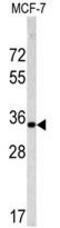 Emerin antibody, GTX81870, GeneTex, Western Blot image 