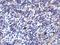 B7RP-1 antibody, A01965, Boster Biological Technology, Immunohistochemistry paraffin image 