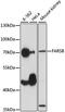 Phenylalanyl-TRNA Synthetase Subunit Beta antibody, A15375, ABclonal Technology, Western Blot image 