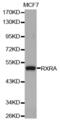 Retinoid X Receptor Alpha antibody, abx002373, Abbexa, Western Blot image 