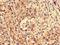 LIM Domain Binding 1 antibody, LS-C672983, Lifespan Biosciences, Immunohistochemistry paraffin image 