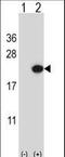 Endothelin-2 antibody, LS-C167625, Lifespan Biosciences, Western Blot image 