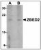 Zinc Finger BED-Type Containing 2 antibody, AP23870PU-N, Origene, Western Blot image 