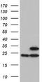 ATP Synthase Peripheral Stalk Subunit OSCP antibody, TA804572, Origene, Western Blot image 