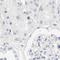 Amphiphysin antibody, NBP1-87561, Novus Biologicals, Immunohistochemistry paraffin image 