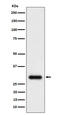 Transmembrane Protein 192 antibody, M11938, Boster Biological Technology, Western Blot image 