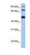 WD Repeat Domain 49 antibody, NBP1-70745, Novus Biologicals, Western Blot image 