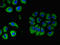 Cholinergic Receptor Muscarinic 5 antibody, LS-C677531, Lifespan Biosciences, Immunofluorescence image 