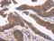 Interleukin 1 Receptor Associated Kinase 1 Binding Protein 1 antibody, LS-C400834, Lifespan Biosciences, Immunohistochemistry paraffin image 