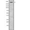 ALMS1 Centrosome And Basal Body Associated Protein antibody, abx216421, Abbexa, Western Blot image 