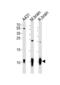 S100 Calcium Binding Protein B antibody, MBS9212013, MyBioSource, Western Blot image 