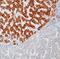 Hepatitis B surface antigen antibody, MA5-13059, Invitrogen Antibodies, Immunohistochemistry frozen image 