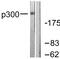 E1A Binding Protein P300 antibody, OAAF01891, Aviva Systems Biology, Western Blot image 