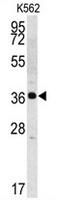 Kallikrein Related Peptidase 2 antibody, AP13358PU-N, Origene, Western Blot image 