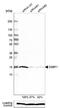 Single Stranded DNA Binding Protein 1 antibody, NBP1-80720, Novus Biologicals, Western Blot image 