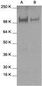Signal Transducer And Activator Of Transcription 2 antibody, GTX27965, GeneTex, Western Blot image 
