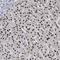 TCF3 Fusion Partner antibody, HPA034958, Atlas Antibodies, Immunohistochemistry paraffin image 