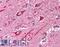 RAD51 Paralog D antibody, LS-C140848, Lifespan Biosciences, Immunohistochemistry frozen image 