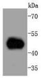Mitogen-Activated Protein Kinase Kinase 5 antibody, A03980-2, Boster Biological Technology, Western Blot image 