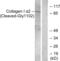 Collagen Type I Alpha 2 Chain antibody, abx015578, Abbexa, Western Blot image 