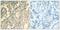 Signal Transducer And Activator Of Transcription 2 antibody, GTX50661, GeneTex, Immunohistochemistry paraffin image 