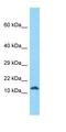 Regulatory Subunit Of Type II PKA R-Subunit (RIIa) Domain Containing 1 antibody, orb327100, Biorbyt, Western Blot image 