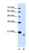 Transmembrane Protein 91 antibody, orb325195, Biorbyt, Western Blot image 