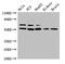 Nuclear Receptor Subfamily 5 Group A Member 2 antibody, CSB-PA016066LA01HU, Cusabio, Western Blot image 